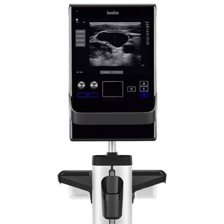Ultrasonido sii en Consorcio Hermes Querétaro
